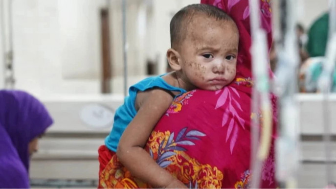 measles